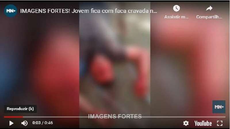 video jovem fica com faca cravada no pescoco apos briga por videogame assista