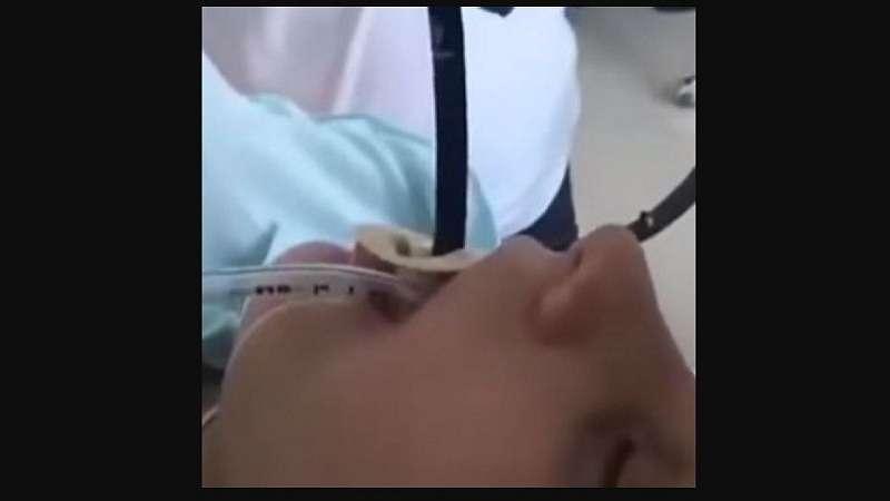 video mostra medicos tirando cobra de 15 metro ainda viva de dentro da boca de uma mulher