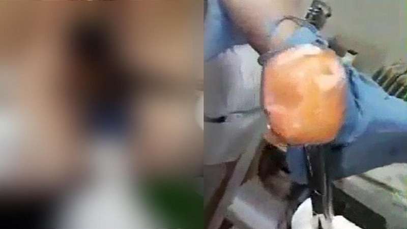 mulher tarada vai parar no hospital com cenoura presa em parte intima veja video